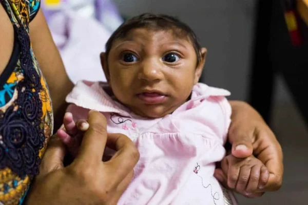 Governo veta projeto do Congresso e decide pagar R$ 60 mil para vítimas da zika.