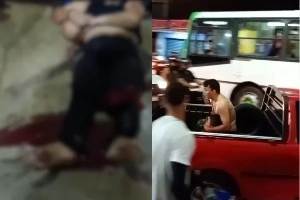 Menino baleado na cabeça continua em estado grave em hospital de Teresina.