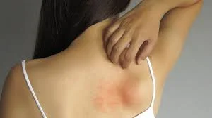MPPI recomenda suspensão de inclusão de fibromialgia como deficiência na Carteira de Identidade.
